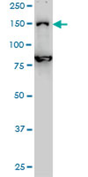 DHX8 monoclonal antibody (M01), clone 1E10