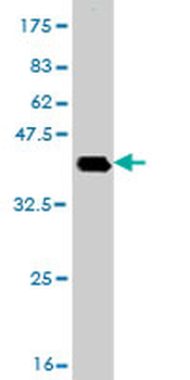 DHX8 monoclonal antibody (M01), clone 1E10