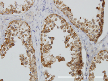 DDX6 monoclonal antibody (M01), clone 3D2