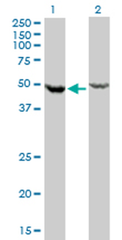 DDX6 monoclonal antibody (M01), clone 3D2