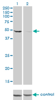 DDX6 monoclonal antibody (M01), clone 3D2