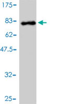 DDX6 monoclonal antibody (M01), clone 3D2
