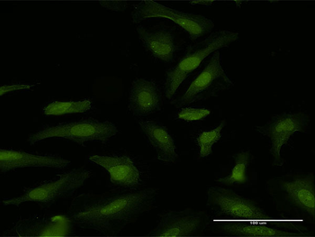DDX6 purified MaxPab rabbit polyclonal antibody (D01P)