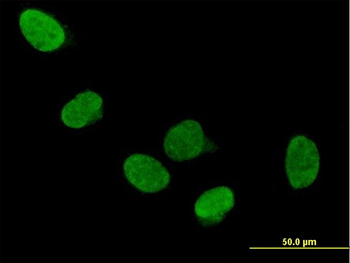 DDX5 purified MaxPab mouse polyclonal antibody (B01P)