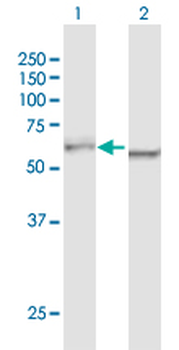 DDX5 purified MaxPab mouse polyclonal antibody (B01P)