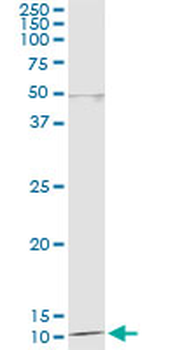 DDT monoclonal antibody (M04), clone 1D5