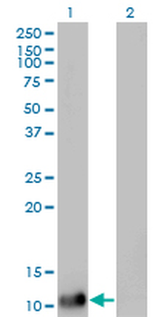 DDT monoclonal antibody (M01), clone 1G1