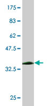 DDT monoclonal antibody (M01), clone 1G1