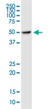 DDOST monoclonal antibody (M06), clone 2D7