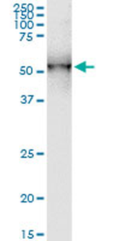 DDOST monoclonal antibody (M06), clone 2D7