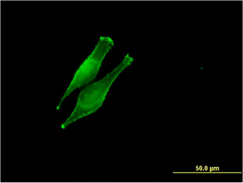 DDOST monoclonal antibody (M06), clone 2D7