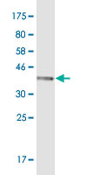 AKR1C1 monoclonal antibody (M01), clone 1B3