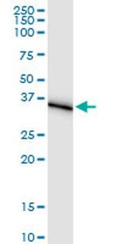 AKR1C1 MaxPab rabbit polyclonal antibody (D01)