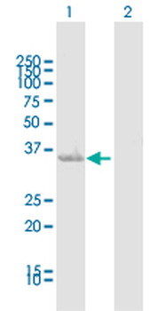 AKR1C1 MaxPab rabbit polyclonal antibody (D01)