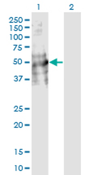 DDC monoclonal antibody (M18), clone 8E8