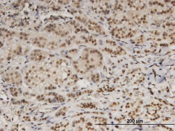 DDB1 monoclonal antibody (M01), clone 4C5