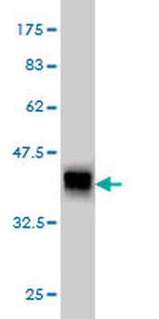 ACE monoclonal antibody (M01), clone 6A4