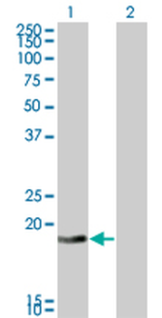 DCTD monoclonal antibody (M01), clone 4B9