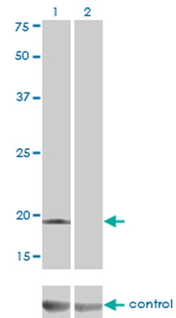 DCTD monoclonal antibody (M01), clone 4B9