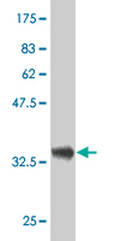 DCTD monoclonal antibody (M01), clone 4B9