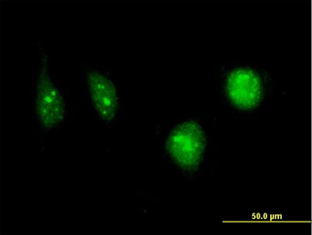 DCK monoclonal antibody (M08), clone 1D12