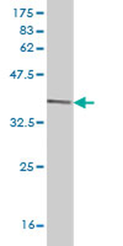 DCK monoclonal antibody (M08), clone 1D12