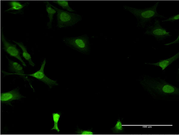 DCK monoclonal antibody (M03), clone 2F10