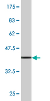 DCK monoclonal antibody (M03), clone 2F10