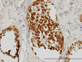 DAZ1 monoclonal antibody (M09), clone 3A4