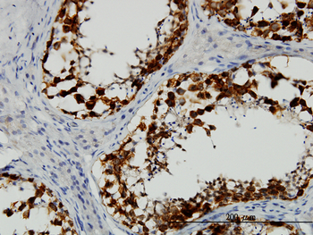 DAZ1 monoclonal antibody (M06), clone 3E3