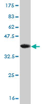 DAZ1 monoclonal antibody (M06), clone 3E3