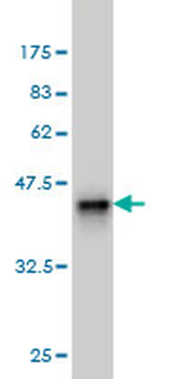 DAZ1 monoclonal antibody (M04), clone 4F3