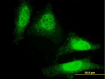 DAZ1 monoclonal antibody (M01), clone 3G10