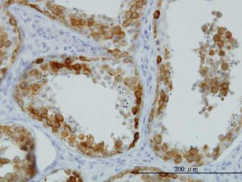 DAZ1 monoclonal antibody (M01), clone 3G10