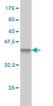 DAZ1 monoclonal antibody (M01), clone 3G10