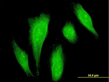 DAXX monoclonal antibody (M03), clone 4C2
