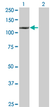 DAXX monoclonal antibody (M03), clone 4C2