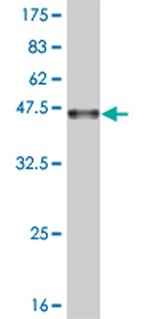 DAXX monoclonal antibody (M03), clone 4C2