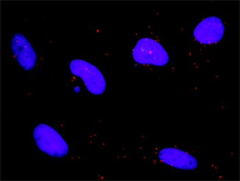 DAPK1 monoclonal antibody (M01), clone 2E7