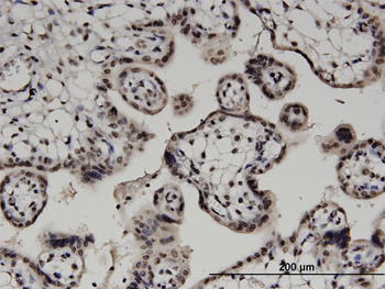 DGKA monoclonal antibody (M02), clone 2B7