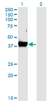DAF monoclonal antibody (M02), clone 1D7