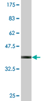 DAF monoclonal antibody (M02), clone 1D7