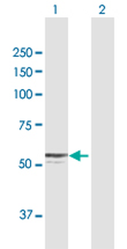CYP27A1 MaxPab rabbit polyclonal antibody (D01)