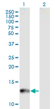 CYP24A1 monoclonal antibody (M07), clone 1F8