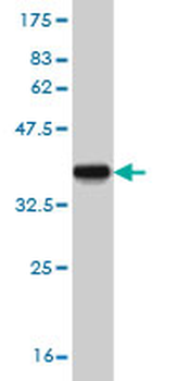 CYP24A1 monoclonal antibody (M07), clone 1F8