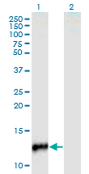CYP24A1 monoclonal antibody (M02), clone 1E1