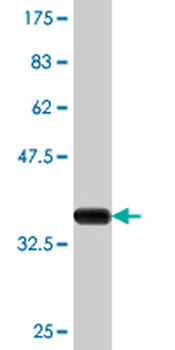 CYP24A1 monoclonal antibody (M02), clone 1E1