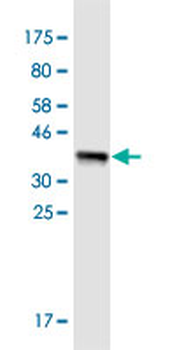 CYP7A1 monoclonal antibody (M01), clone 8F1