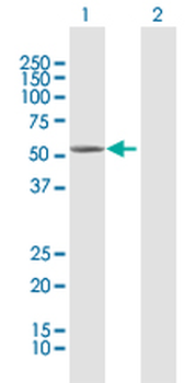 CYP4B1 MaxPab rabbit polyclonal antibody (D01)
