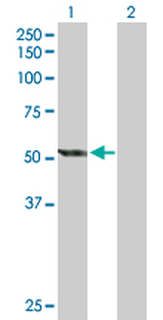 CYP2E1 purified MaxPab rabbit polyclonal antibody (D01P)